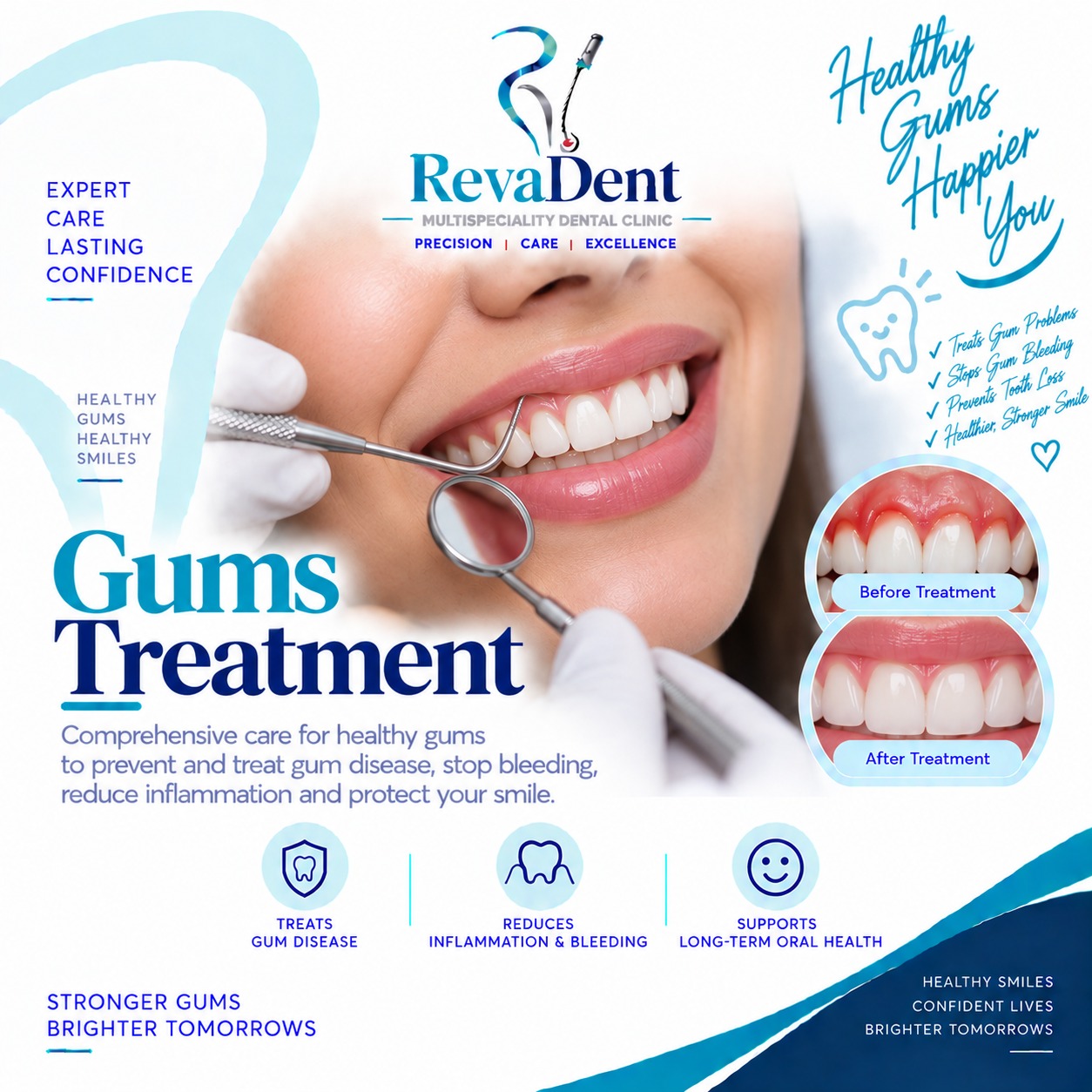 Gum Treatment at RevaDent Pimple Saudagar