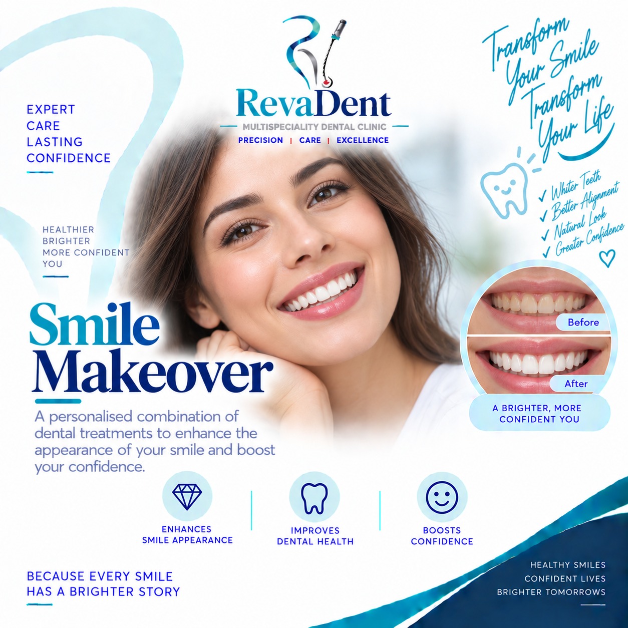 Smile Design at RevaDent Pimple Saudagar