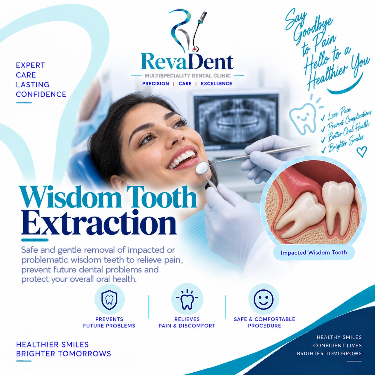 Wisdom Tooth Removal at RevaDent Pimple Saudagar