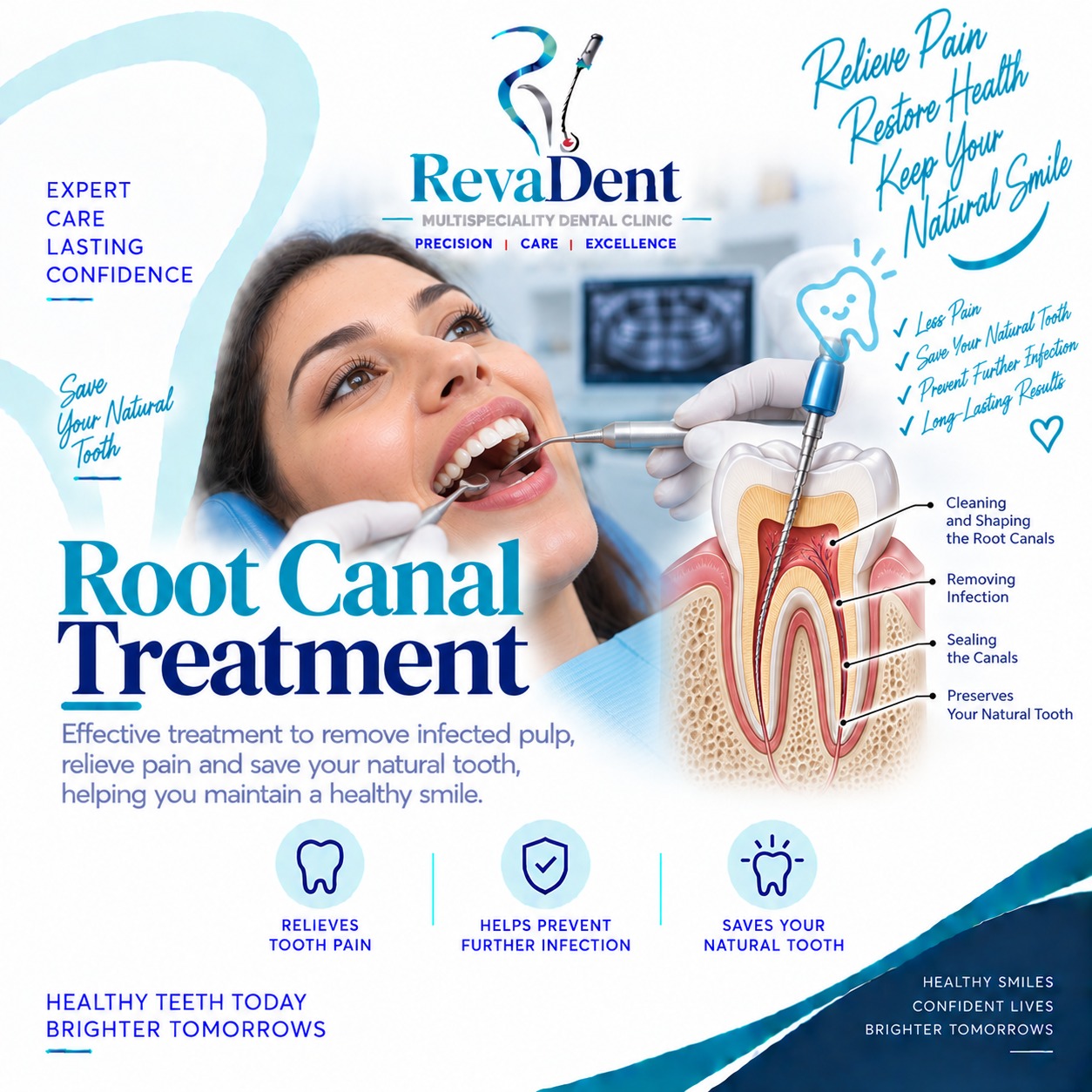 Root Canal Treatment at RevaDent Pimple Saudagar