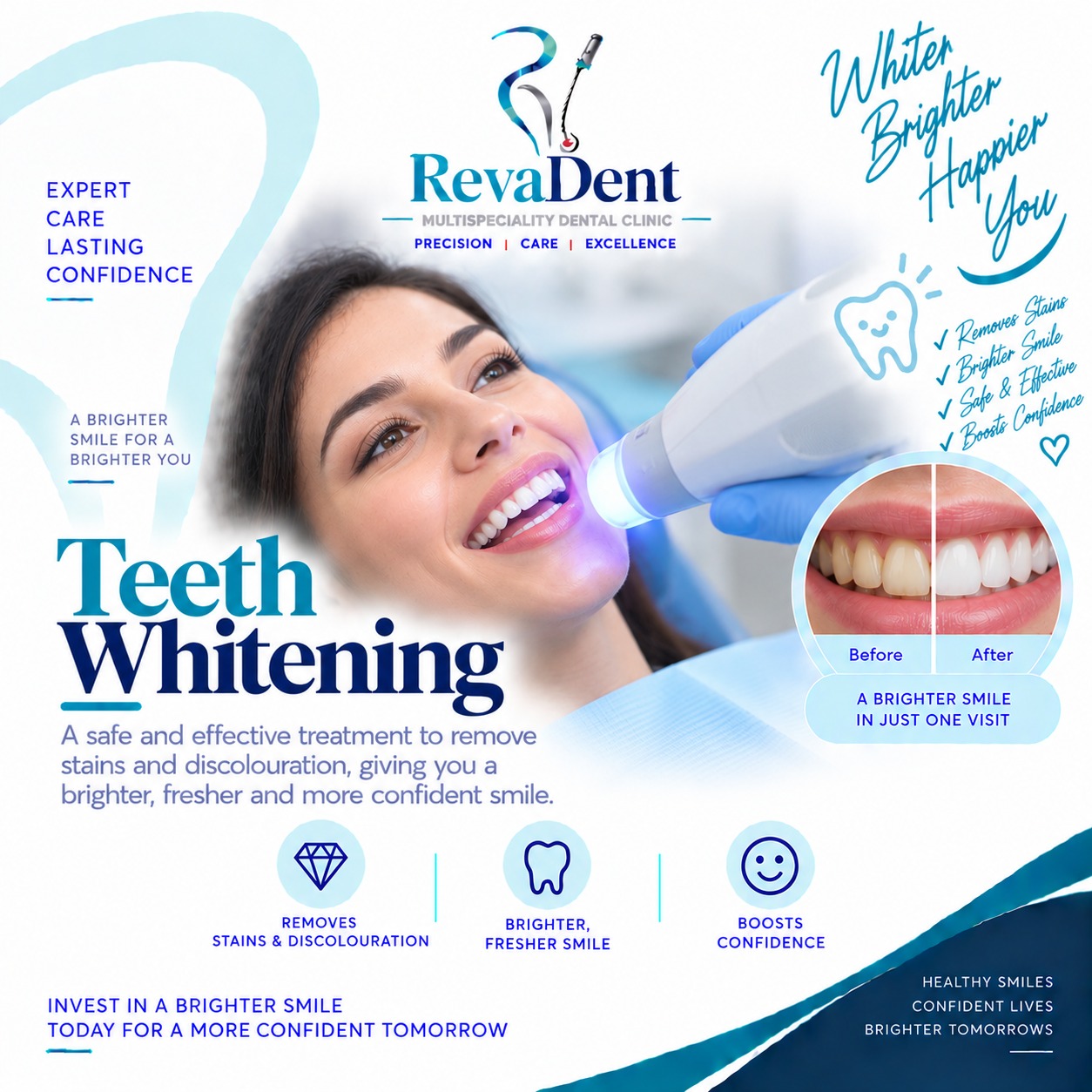Teeth Whitening at RevaDent Pimple Saudagar