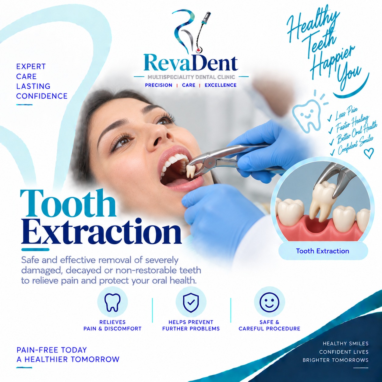 Tooth Extraction at RevaDent Pimple Saudagar